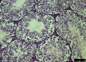 HE Stain Testis